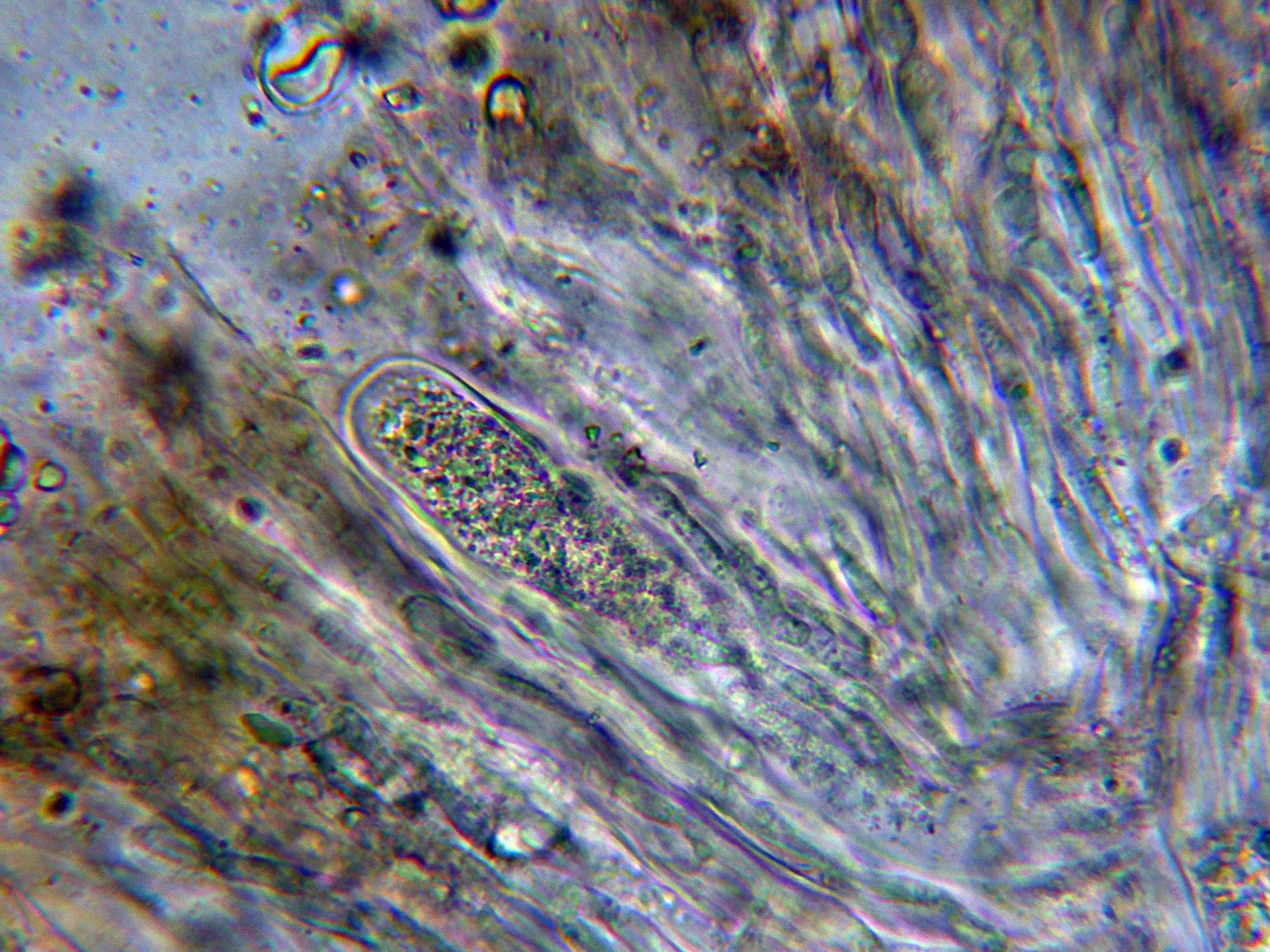 Microscopía de Lobothallia radiosa - 10 - Asco-001